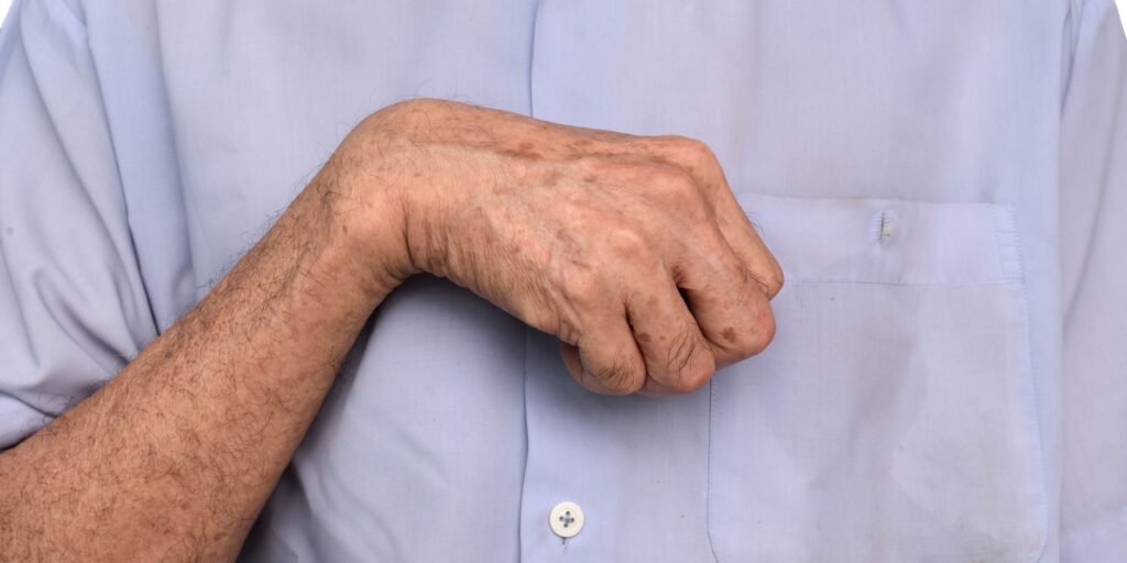 rigidez matutina en enfermedad degenerativa