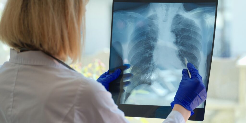 radiografia de pulmones